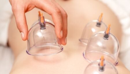 Hacamat Nerelere Yapılır? Hacamat Zamanları Ne Zamandır?